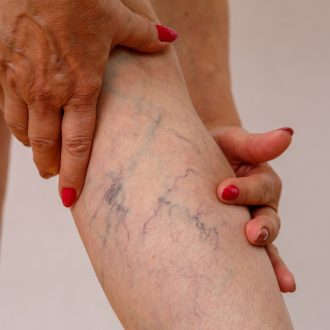 Angiologia